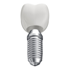 Realistic 3D Modeling PNG File of Dental Implant Tooth with Transparent Background