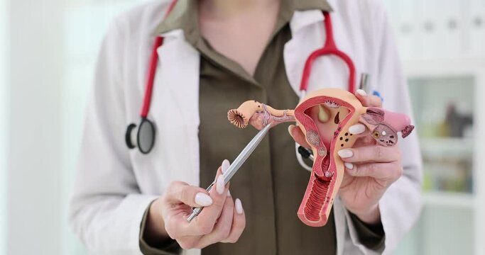 Female gynecologist demonstrates a model of the female reproductive system