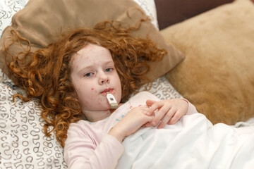 Sad little girl with chickenpox at home. Varicella virus.