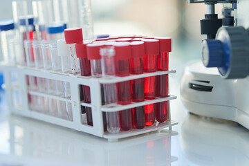 Medical research, test tubes and tray for scientific analysis, experiment and innovation in...