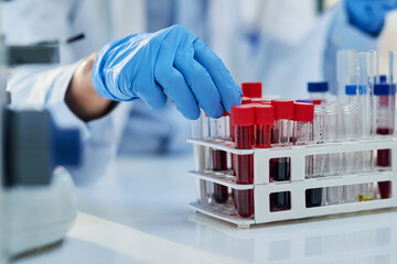 Science, blood test and hands of person with sample for biotech engineering, pathology and...