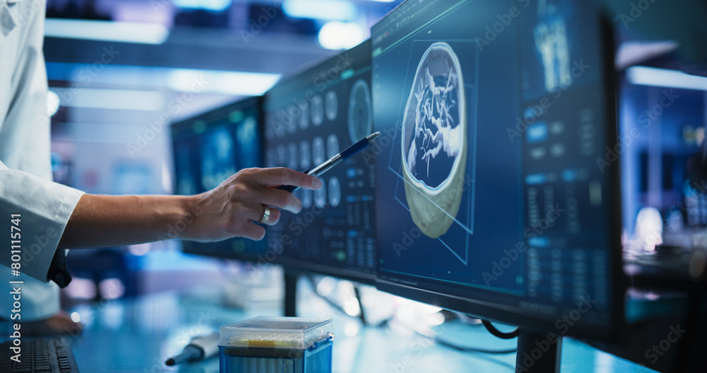 Aufkleber Modern Medical Research Center: Anonymous Doctor Pointing At Desktop Computer Monitor With Software Visualizing Human Brain Based On MRI Scan. Neurologist Looking For Impacted Areas By Brain Damage.