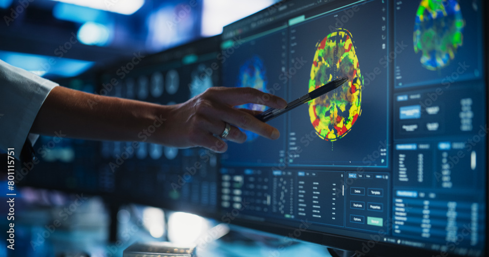 Poster modern medical research center: anonymous doctor pointing at desktop computer monitor with ct scan o
