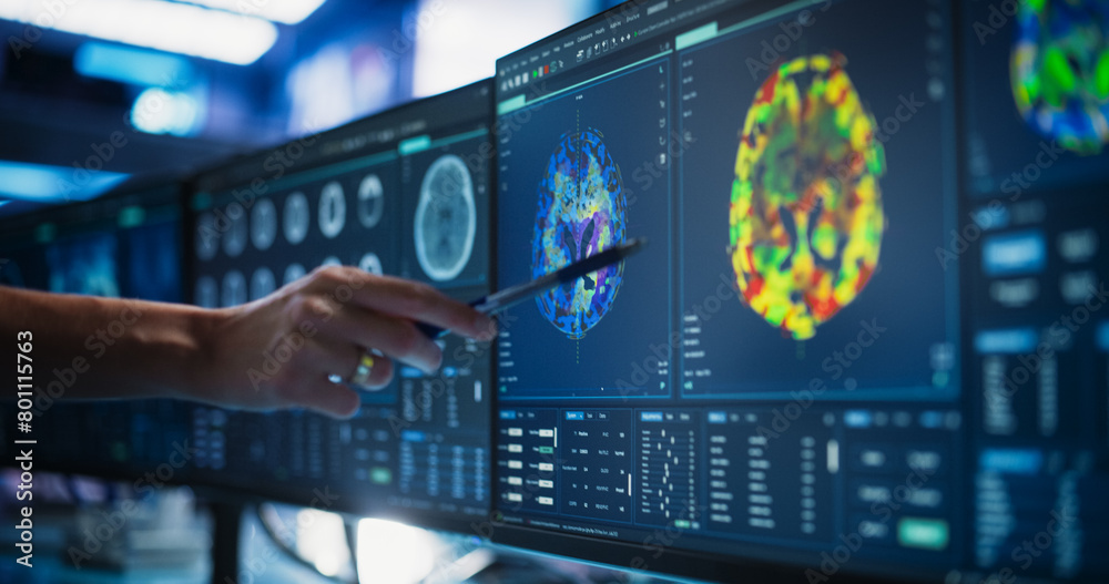 Poster modern medical research center: anonymous doctor pointing at desktop computer monitor with ct scan o