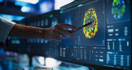 Modern Medical Research Center: Anonymous Doctor Pointing At Desktop Computer Monitor With CT Scan...