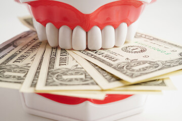 Treatment dental care cost, dental expense or fee, US dollar banknote money with teeth model.