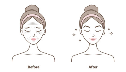 Before and after wrinkles on woman face vector illustration isolated on white background. Comparison of aging, damaged and beauty skin in cartoon style. Skin care and beauty concept.