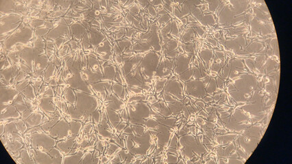 Photo taken from a microscope observing human cell culture in a biological research laboratory in...