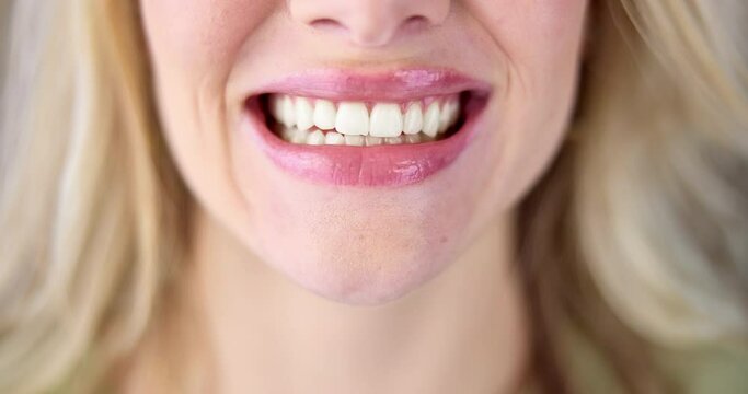 Dentistry, process and woman teeth for before and after with whitening for oral care cosmetics. Happy, smile and female person with mouth for dental hygiene treatment for stain removal versus results