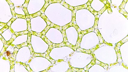 The water net (Hydrodictyon sp) under microscope. Collected from paddy fields in Indonesia. 