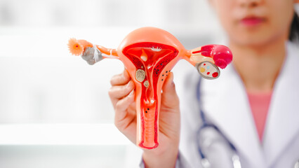 Female doctor specializing in online consultations for reproductive health issues endometriosis,...