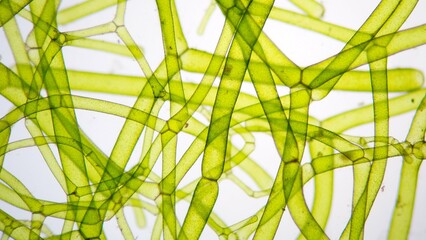 The water net (Hydrodictyon sp) under microscope. Collected from paddy fields in Indonesia. Stacked...
