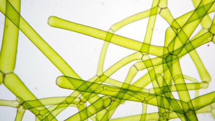 The water net (Hydrodictyon sp) under microscope. Collected from paddy fields in Indonesia. Stacked...