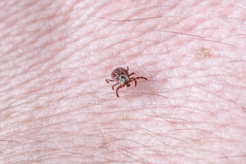 Adult female tick - Ixodes ricinus.A predatory parasitic tick crawls along the human body.Carrier of infectious diseases as encephalitis or Lyme borreliosis.