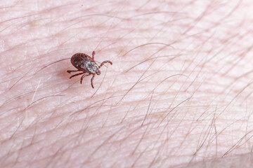 Adult female tick - Ixodes ricinus.A predatory parasitic tick crawls along the human body.Carrier of infectious diseases as encephalitis or Lyme borreliosis.
