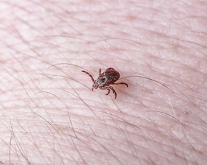 Adult female tick - Ixodes ricinus.A predatory parasitic tick crawls along the human body.Carrier of infectious diseases as encephalitis or Lyme borreliosis.