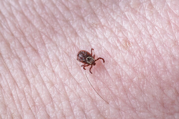 Adult female tick - Ixodes ricinus.A predatory parasitic tick crawls along the human body.Carrier of infectious diseases as encephalitis or Lyme borreliosis.