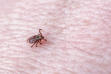 Adult female tick - Ixodes ricinus.A predatory parasitic tick crawls along the human body.Carrier of infectious diseases as encephalitis or Lyme borreliosis.