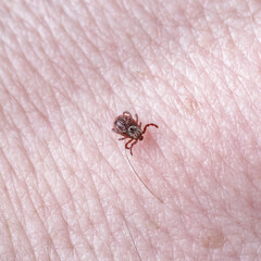 Adult female tick - Ixodes ricinus.A predatory parasitic tick crawls along the human body.Carrier...