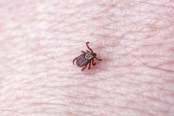 Adult female tick - Ixodes ricinus.A predatory parasitic tick crawls along the human body.Carrier of infectious diseases as encephalitis or Lyme borreliosis.