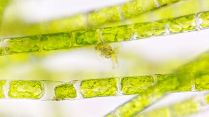 Freshwater filamentous green algae, Microspora sp. Live cell. 400x magnification + 2.6x camera...
