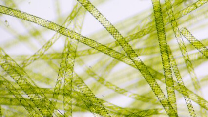 Spirogyra, a filamentous freshwater green algae with spiral arrangement of the chloroplasts. 260x...