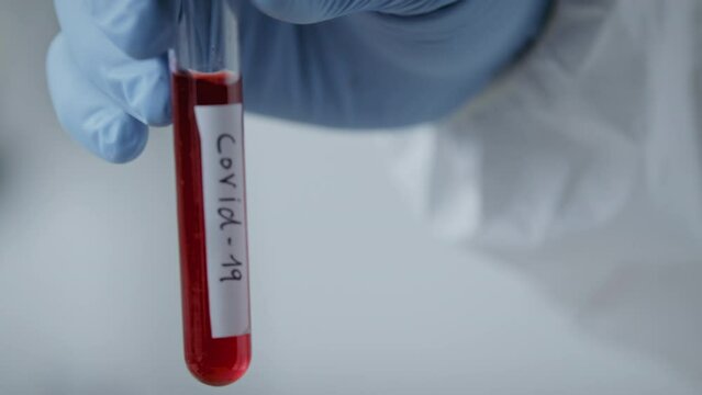 Person wearing disposable gloves holding a vial with blood tested positive for covid-19
