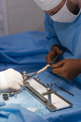 surgeons work on the cut part of the knee joint (muscular ligament) before implanting it back into...