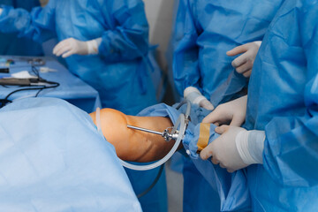 02.01.2024 Vinnytsia, Ukraine: two trauma surgeons work on a patient's knee joint reconstruction on...