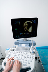 close-up in the clinic gynecological office screening monitor pregnancy duration