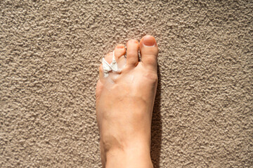 A crack in the bone on a woman's toe against the background of a beige carpet. Taping on the finger