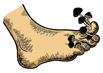 Nail fungus disease mushrooms metaphor sketch engraving PNG illustration. Tee shirt apparel print design. Scratch board style imitation. Black and white hand drawn image. © Oleksandr Pokusai