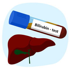 bilirubin test