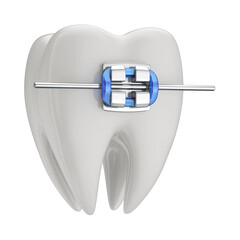 Tooth with braces in 3d isolated transparent background. Tooth 3d icon. Health, dental clinic or...