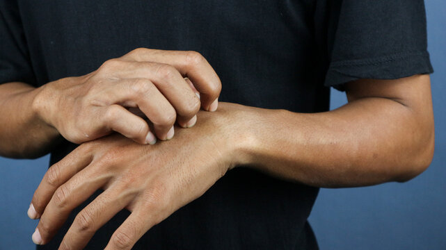 Asian young man scratching his hand isolated on blue background.