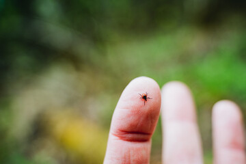 Closeup of a persons finger showing a tick attached