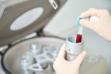 Nurse inserting vacutainer with blood sample into centrifuge