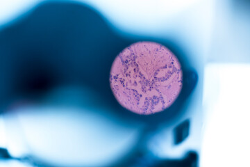 Selective focus human cells tissue in eyepiece of microscope in laboratory.Examining histological...