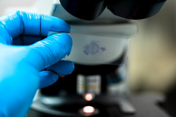 Scientist wear blue glove holding slide human tissue and out of focus microscope.Doctor is...
