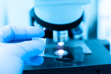 Scientist wear blue glove holding slide human tissue and out of focus microscope.Doctor is...