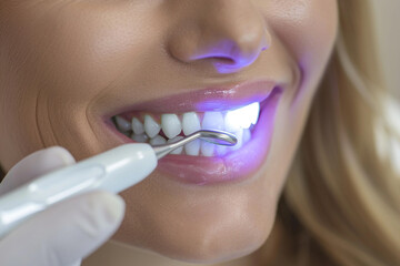 Close-up on a woman's smile undergoing whitening treatment, reflecting beauty and dental health enhancements 