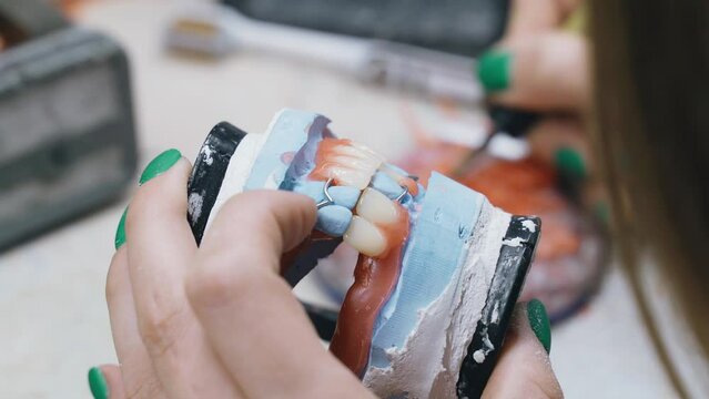 A dental technician works with hot molten wax to make a denture. Close-up.
