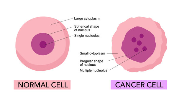 Cancer cell and Normal cell. comparison and difference between healthy tissue and tumor.