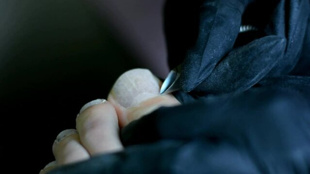 Close up video of podology pedicure