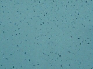 rain drops on window