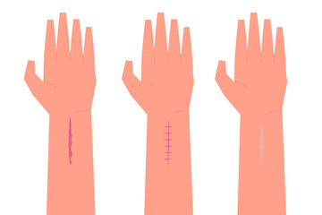 Fototapeta premium Hand cut blood, First aid treatment concept. Flat vector illustration