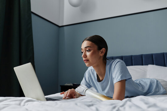 Woman with arm prosthesis using laptop lying on bed in bedroom