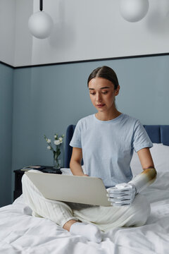 Woman with arm prosthesis using laptop sitting on bed in bedroom at home