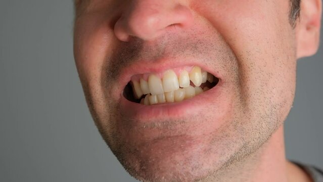 Emotional man bared his teeth, irritability close-up.
