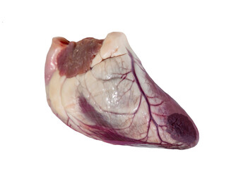 A heart that has suffered a myocardial infarction. Myocardial infarction on a real heart